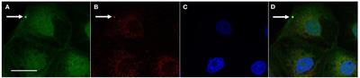 Evaluation of the role of clathrin and bacterial viability in the endocytosis of Lawsonia intracellularis